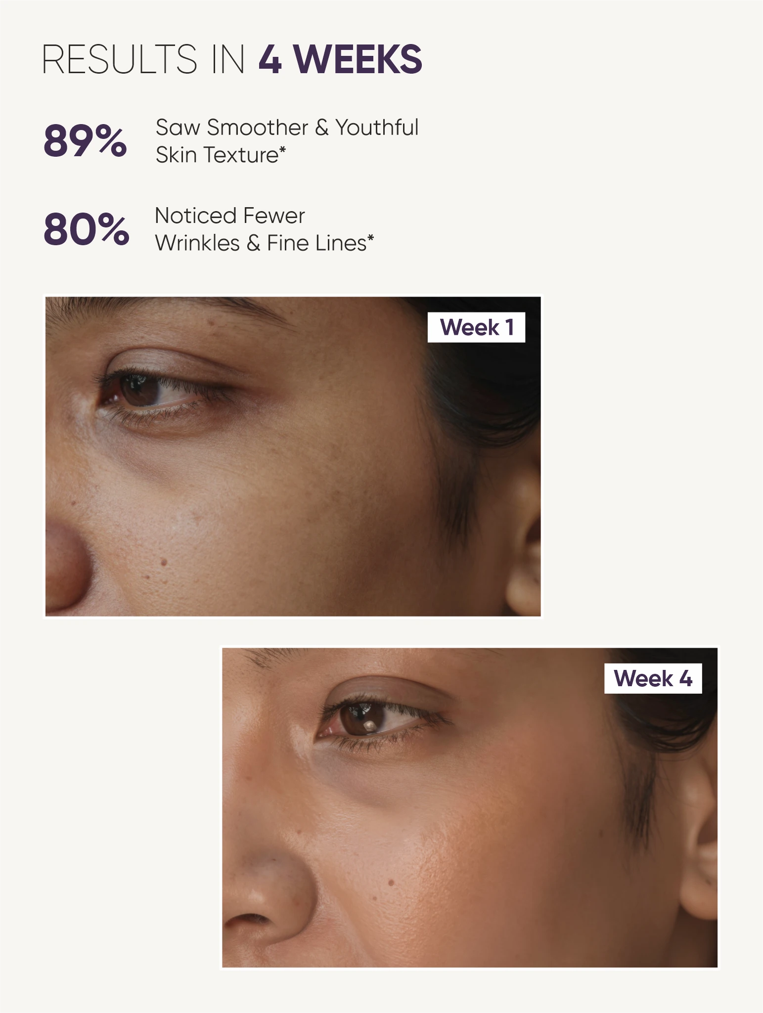 Night Cream Before After Results | Visible Skin Improvement in 4 Weeks | Milau Night Cream